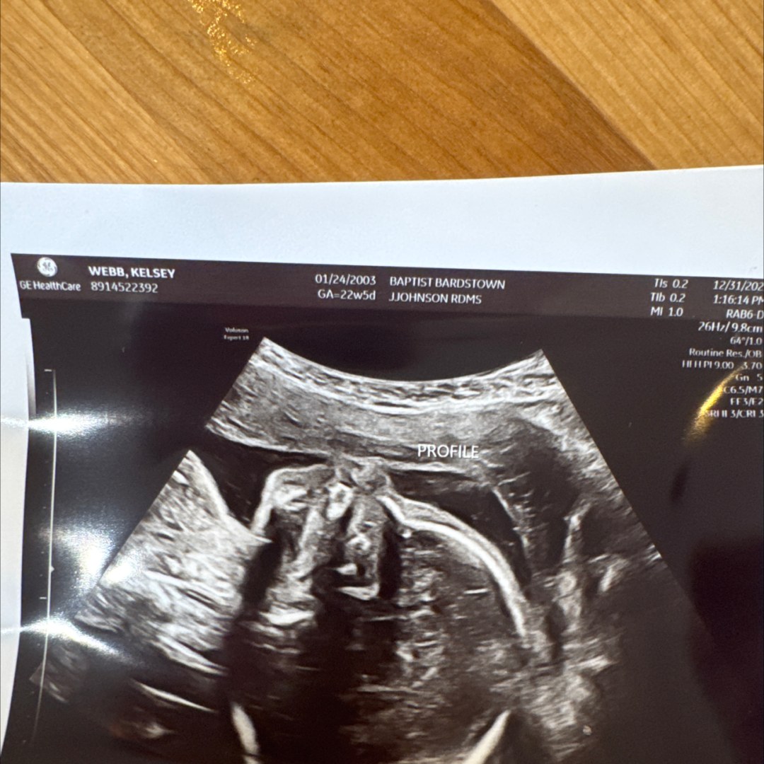 Photo shared by Kelsey for their Babylist baby registry.