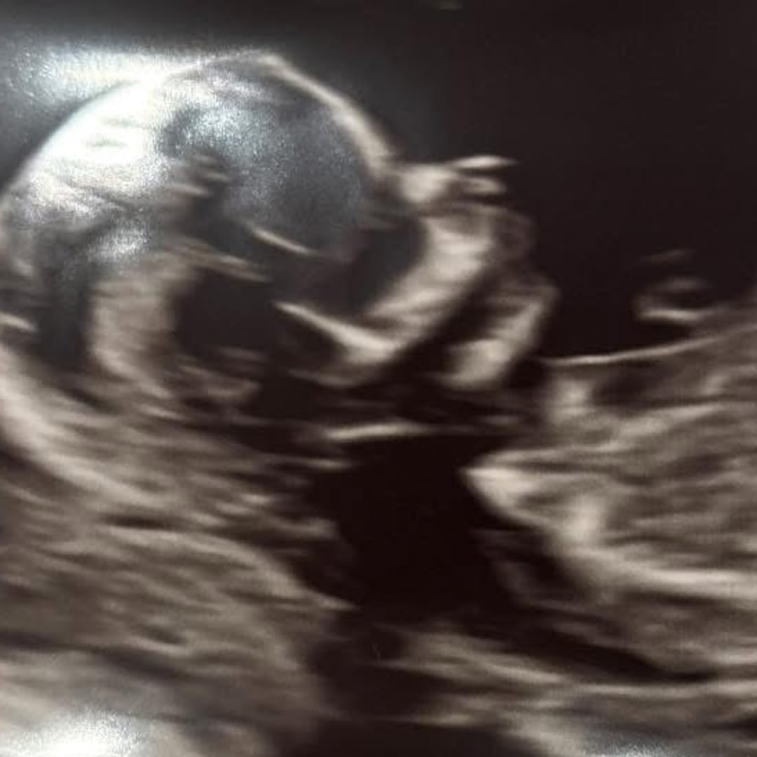 Photo shared by Jaleyda for their Babylist baby registry.