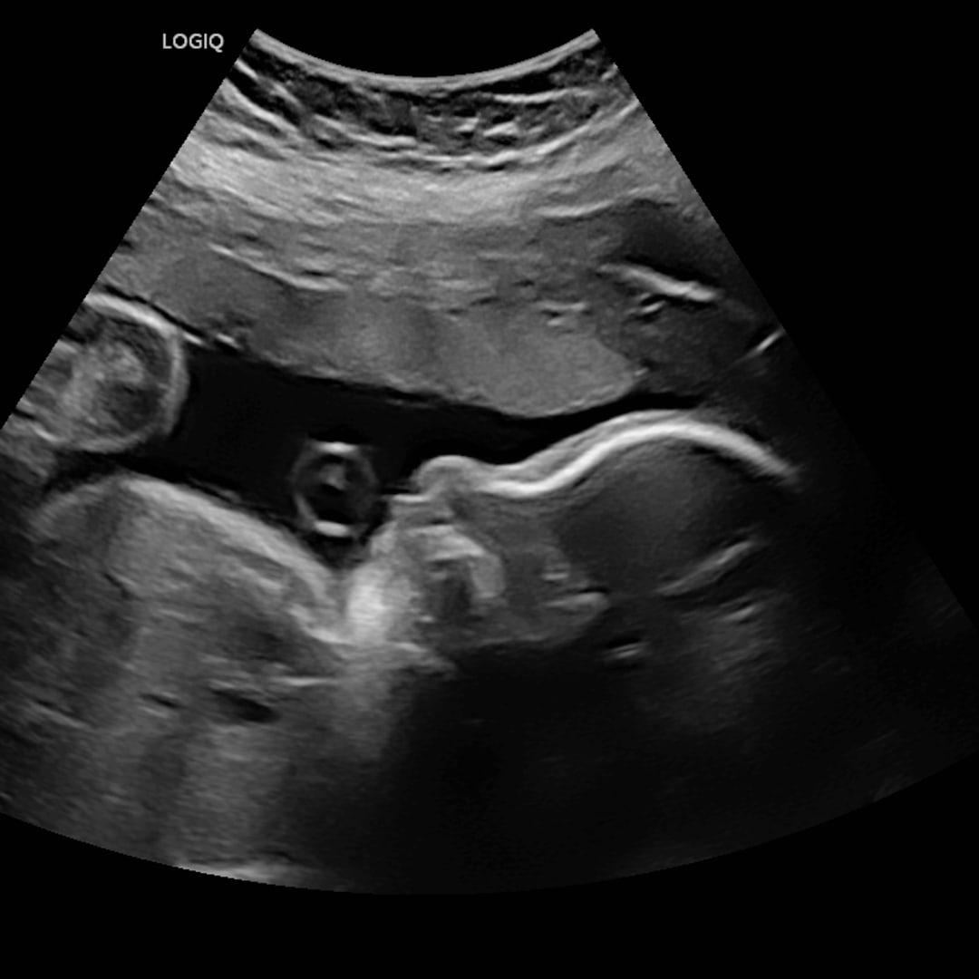 Photo shared by Justin for their Babylist baby registry.