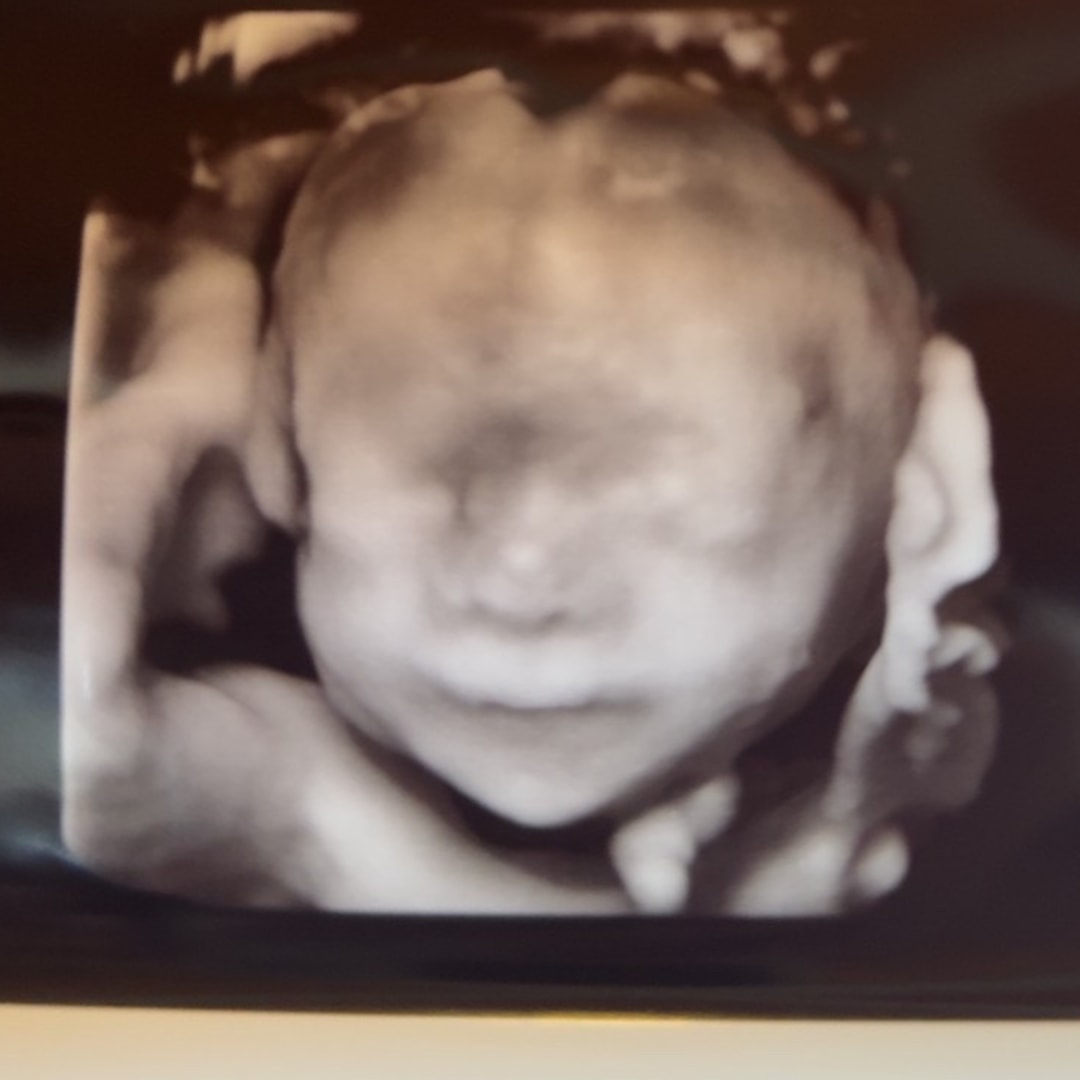 Photo shared by Carlene for their Babylist baby registry.