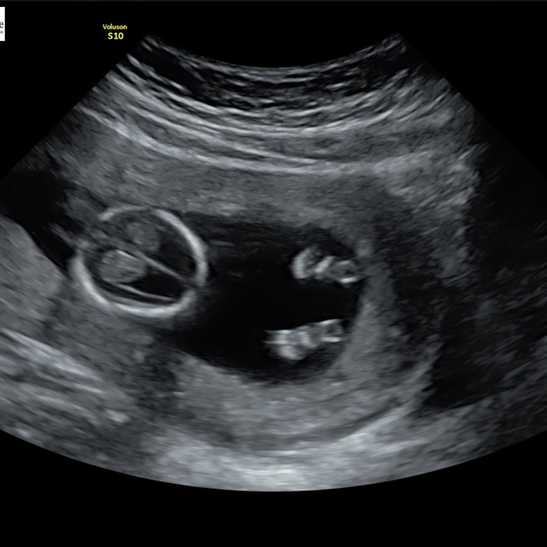 Photo shared by Anya for their Babylist baby registry.