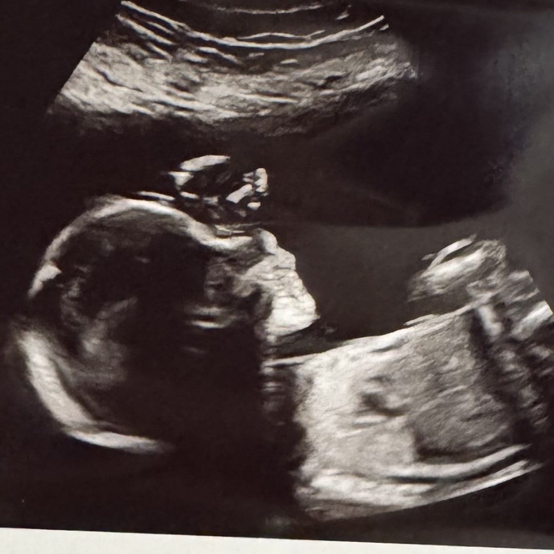Photo shared by Christa for their Babylist baby registry.