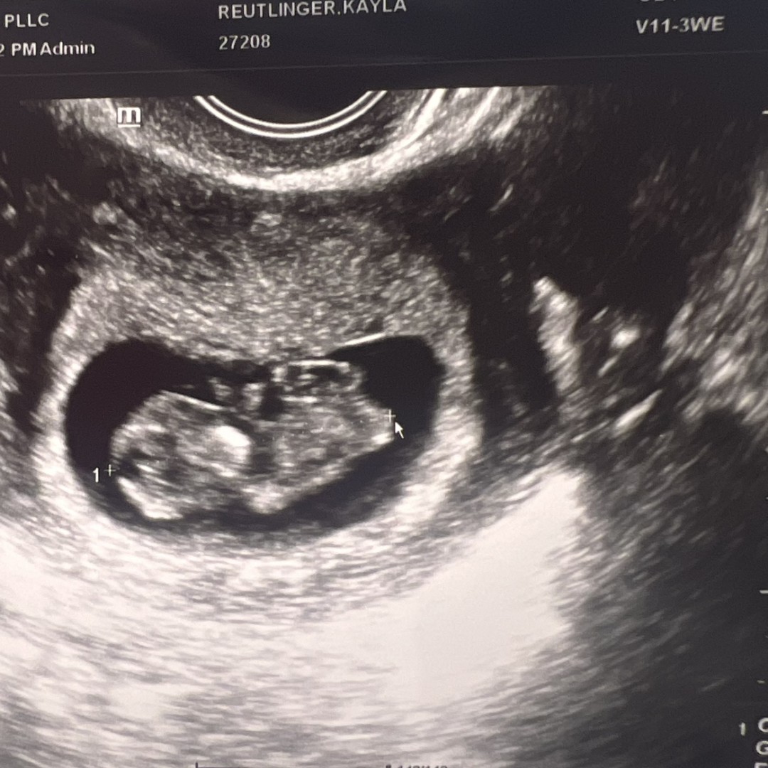 Photo shared by Kayla for their Babylist baby registry.