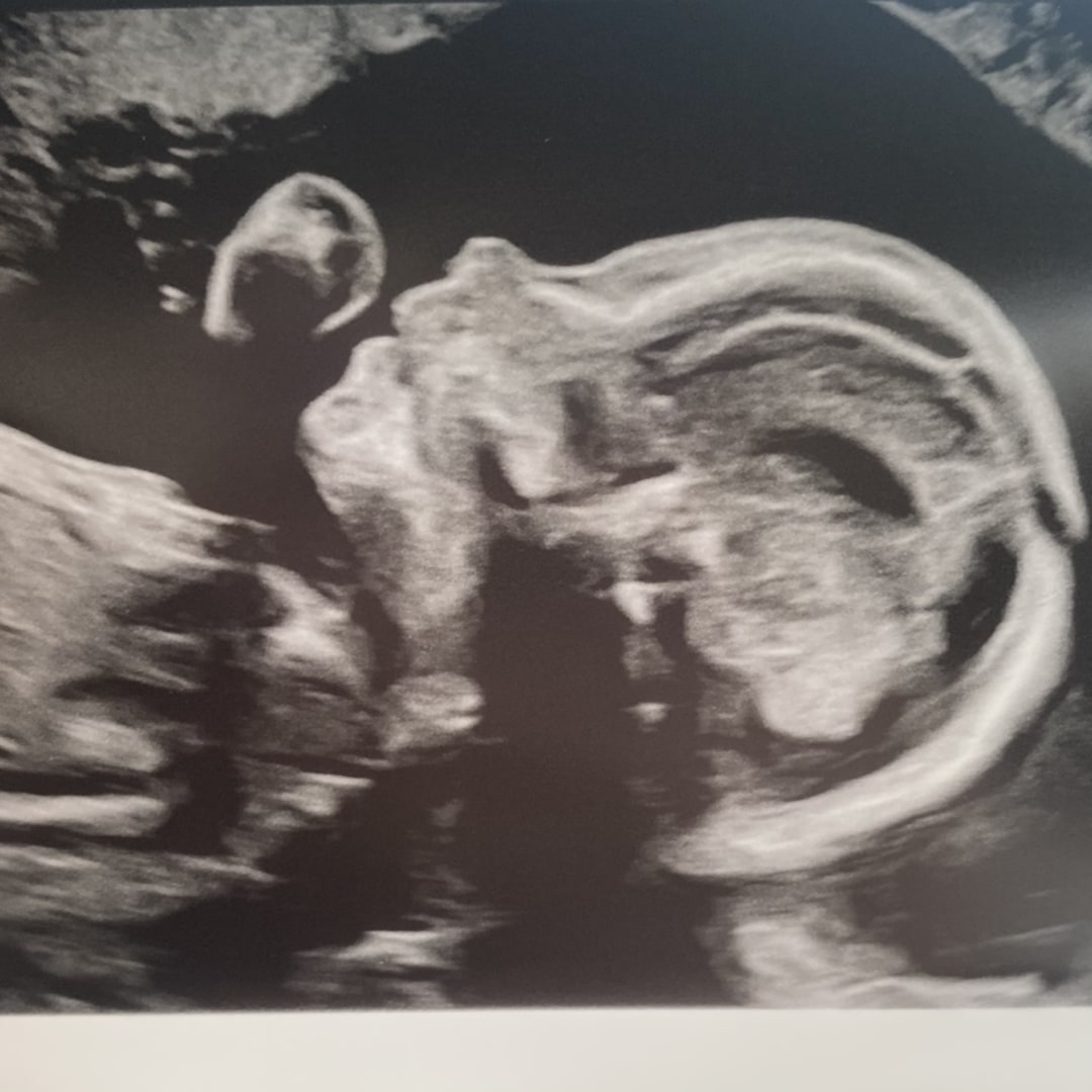 Photo shared by Dawn for their Babylist baby registry.