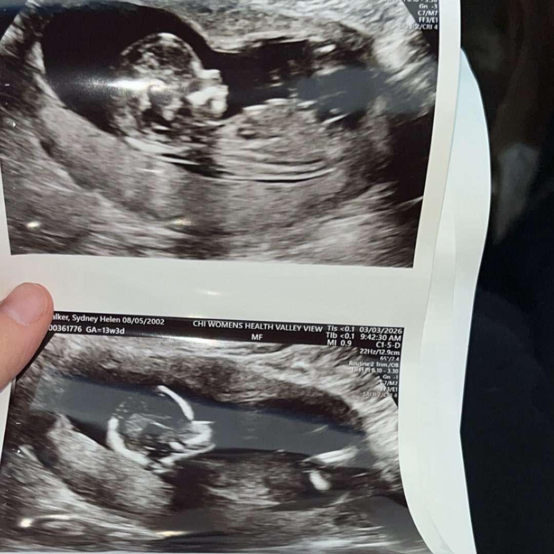 Photo shared by Sydney for their Babylist baby registry.