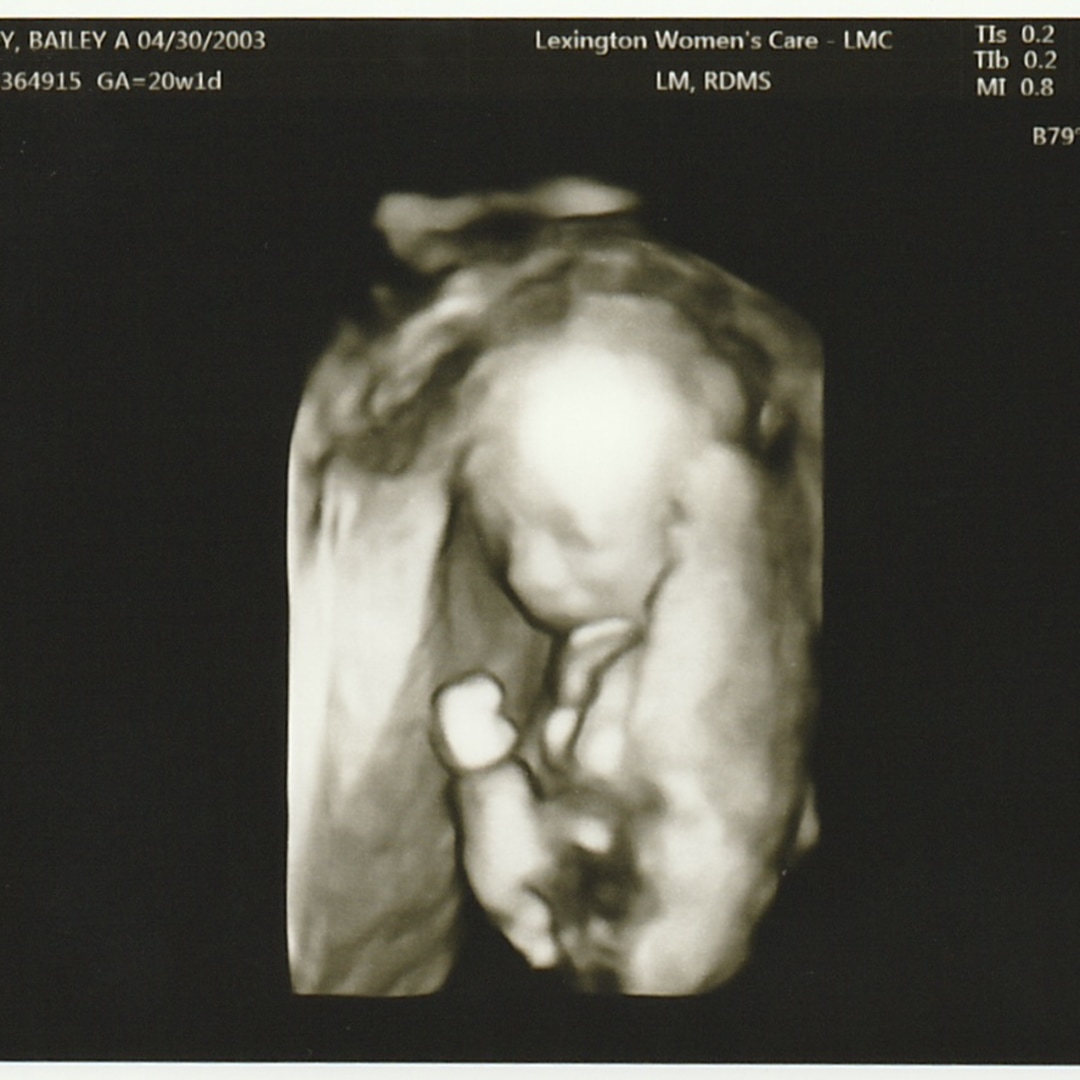Photo shared by Bailey for their Babylist baby registry.