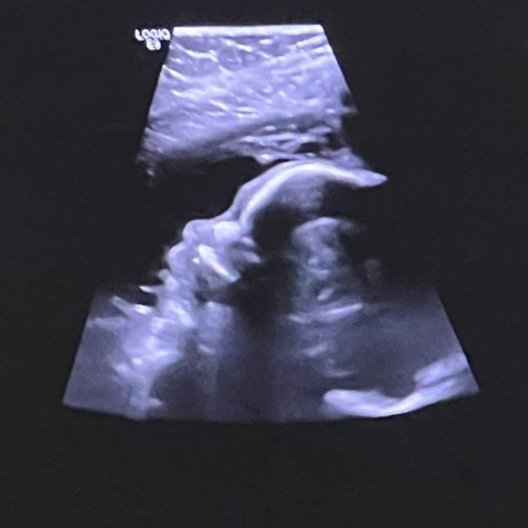 Photo shared by Hortens for their Babylist baby registry.