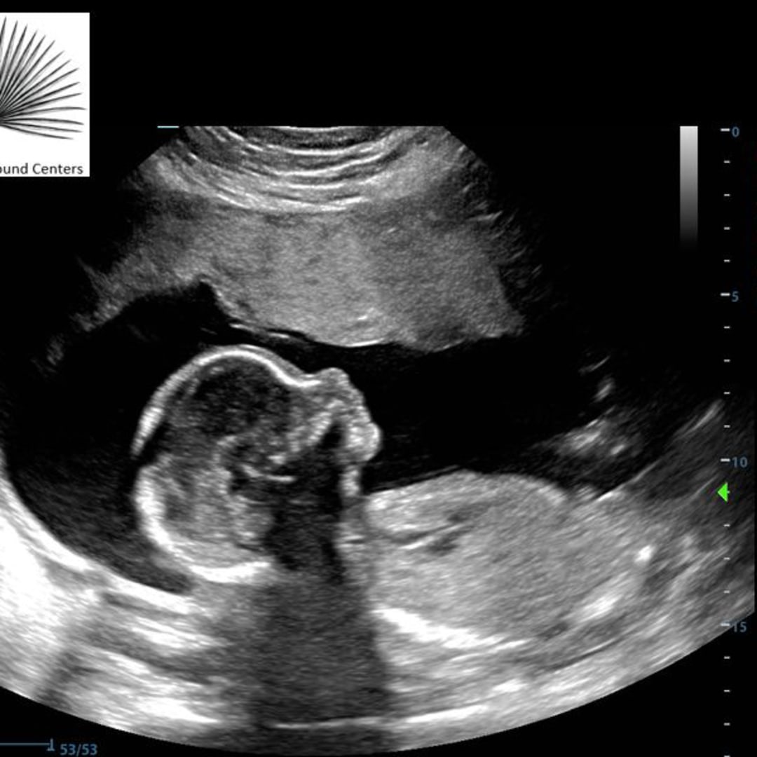 Photo shared by Grace for their Babylist baby registry.