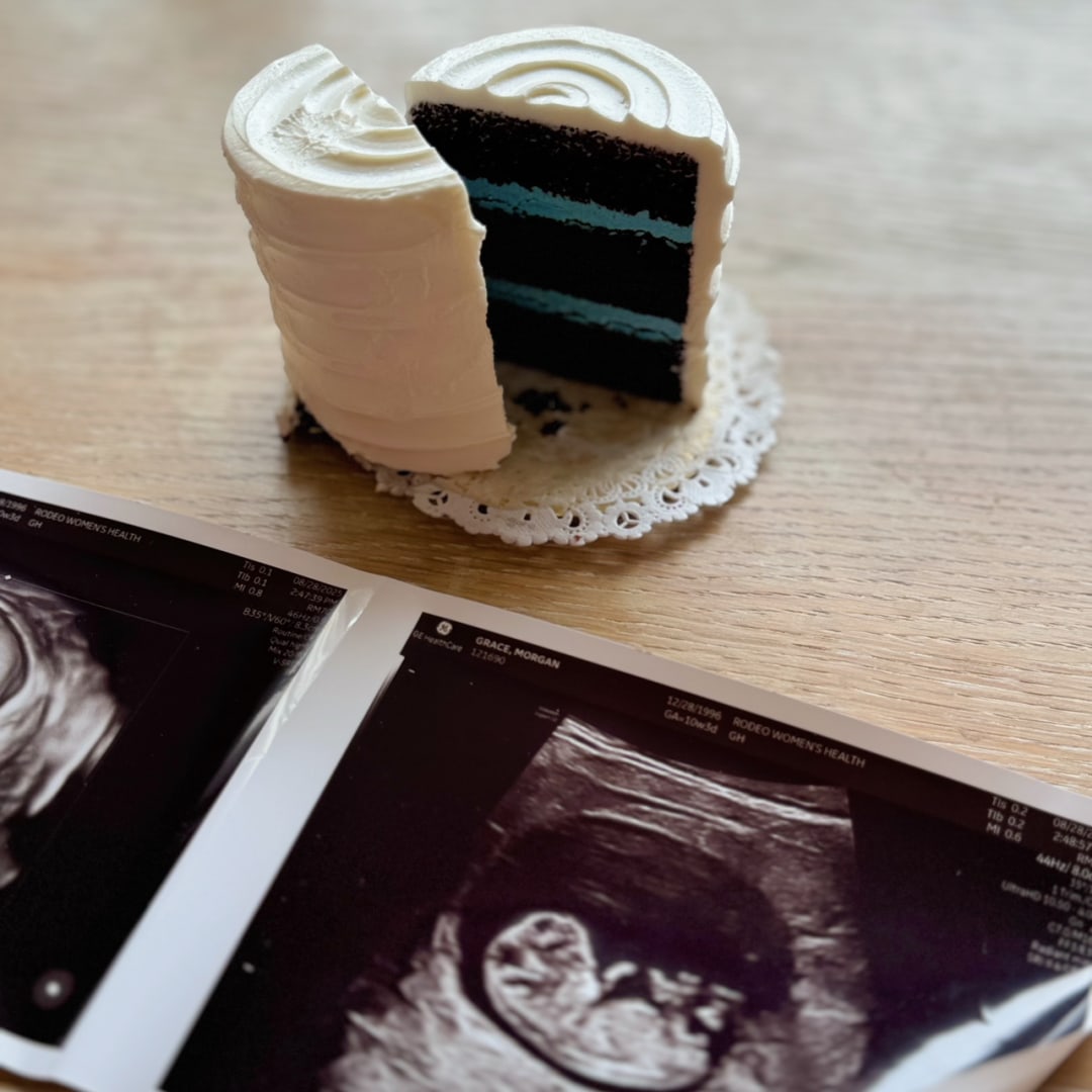 Photo shared by Morgan for their Babylist baby registry.