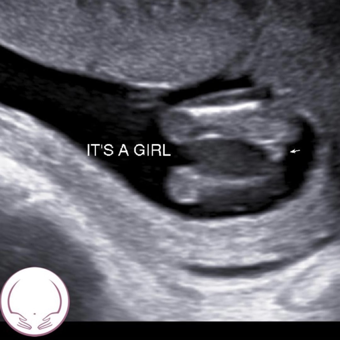 Photo shared by Victoria for their Babylist baby registry.