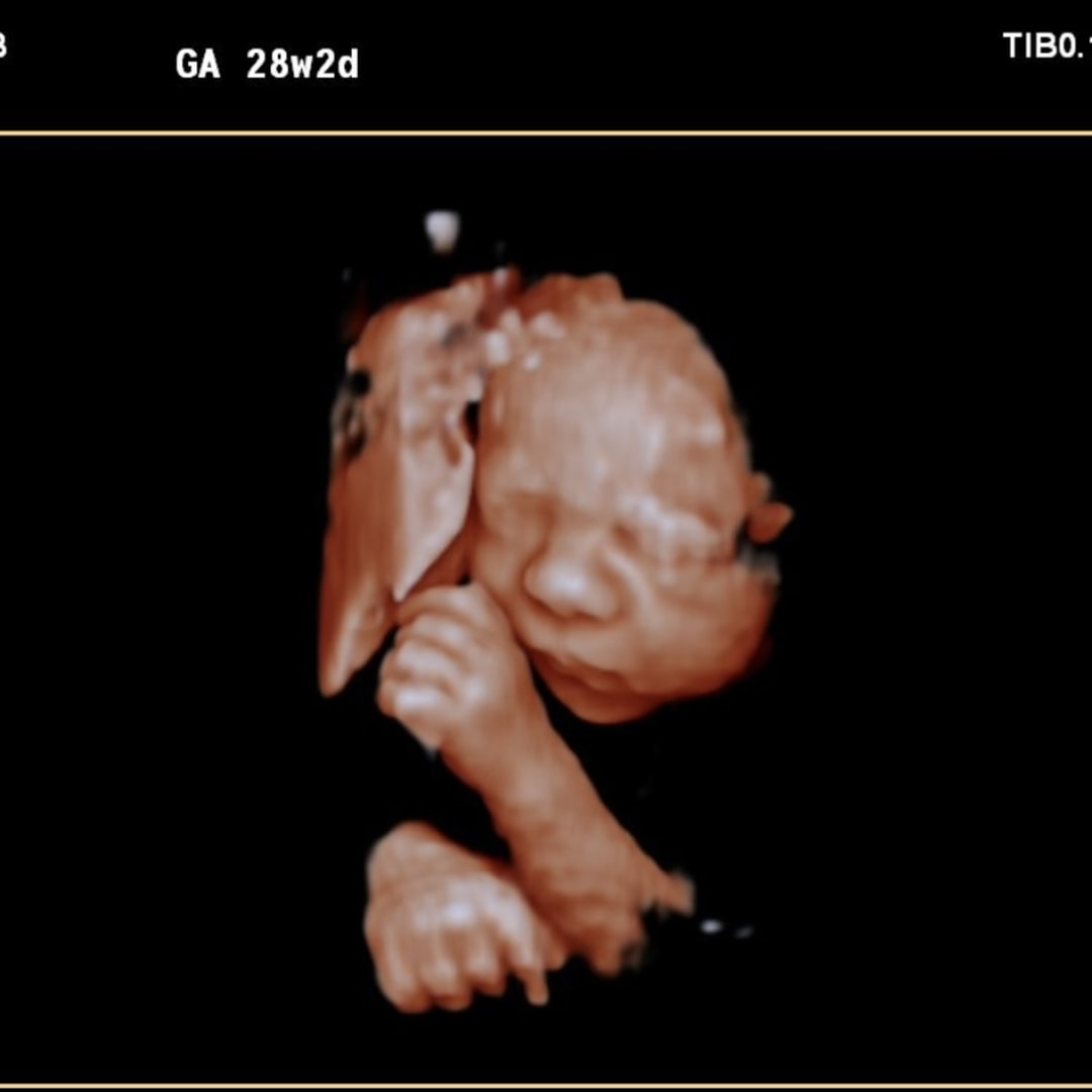 Photo shared by Rachael for their Babylist baby registry.