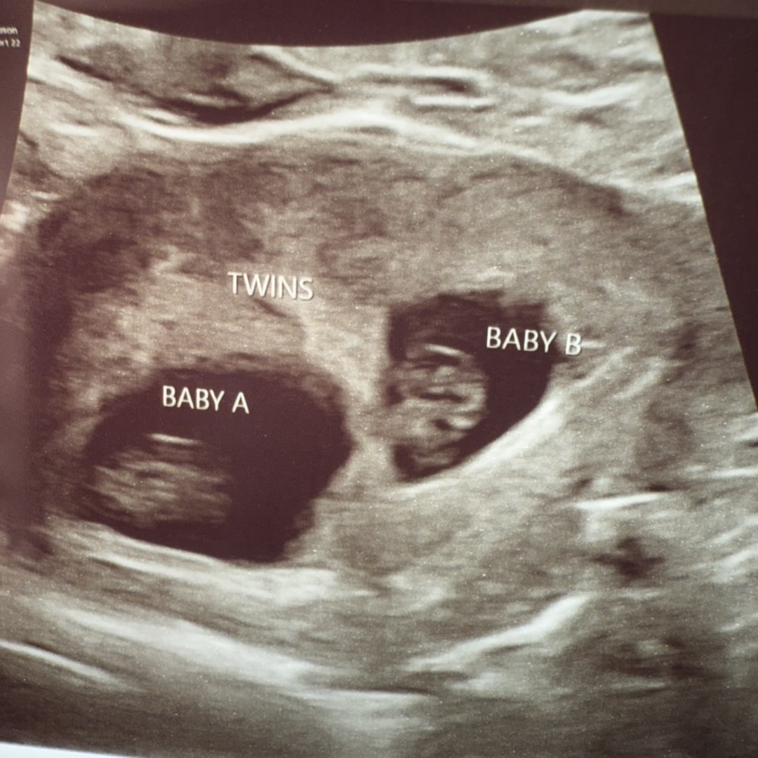 Photo shared by D’nasja for their Babylist baby registry.