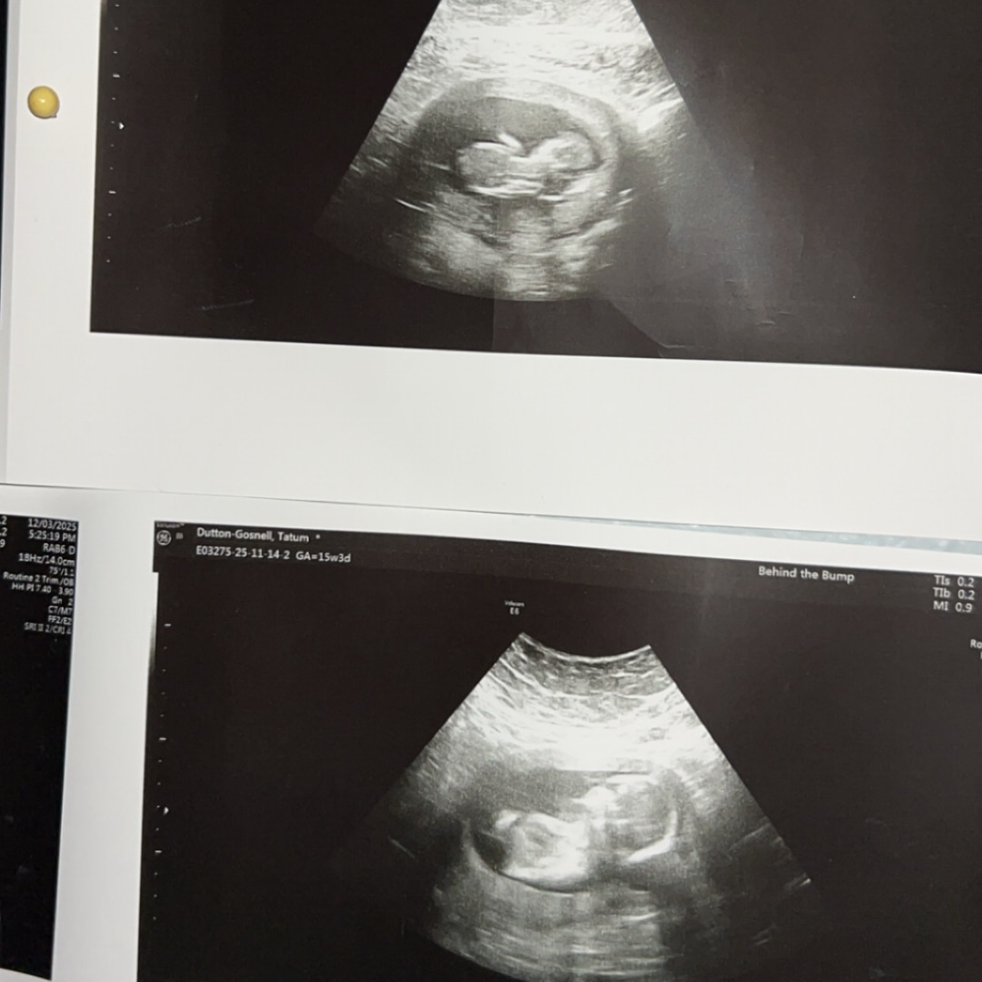 Photo shared by Tatum for their Babylist baby registry.