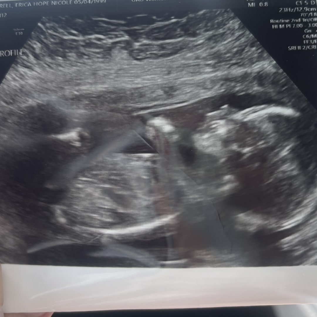 Photo shared by Hope for their Babylist baby registry.