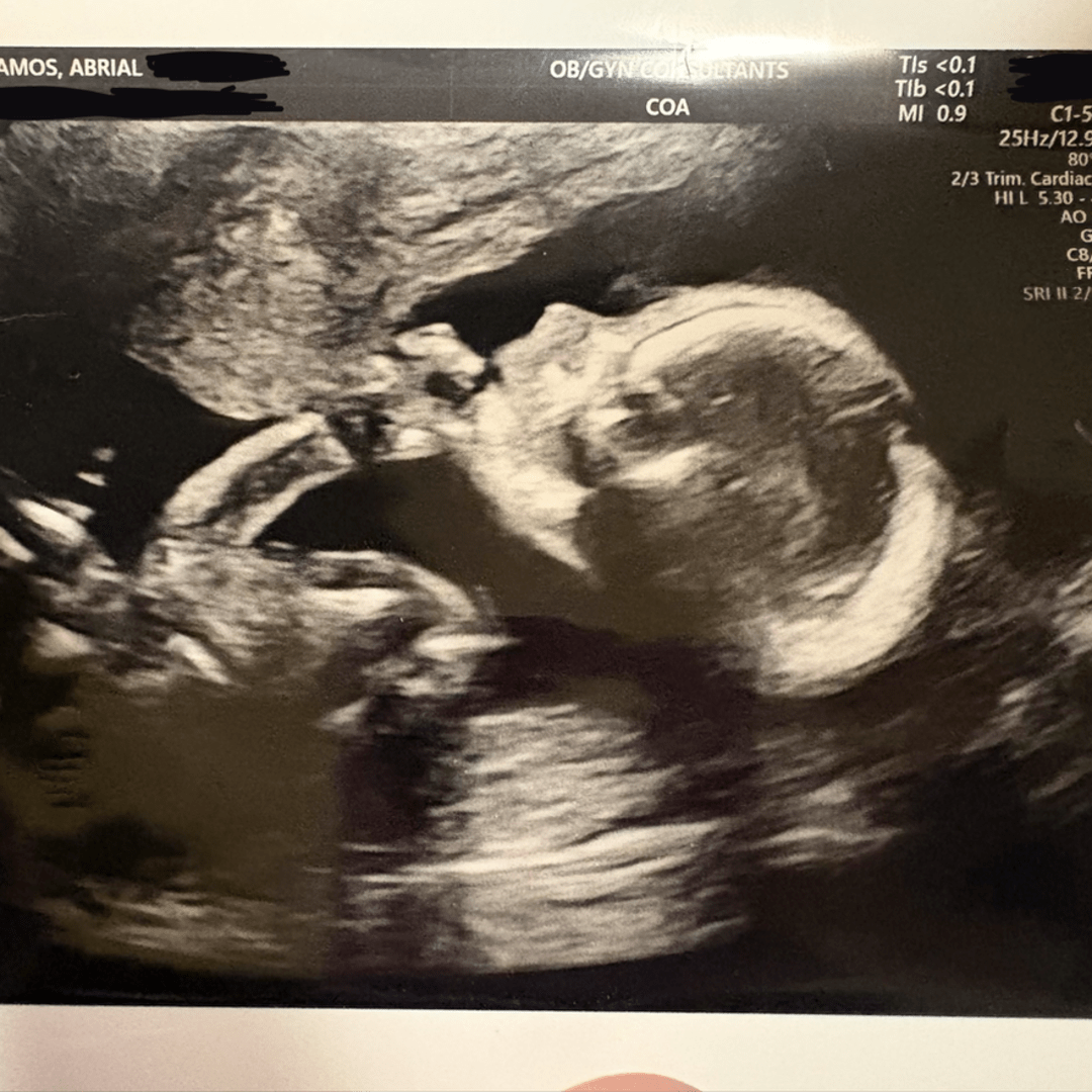 Photo shared by Abby for their Babylist baby registry.