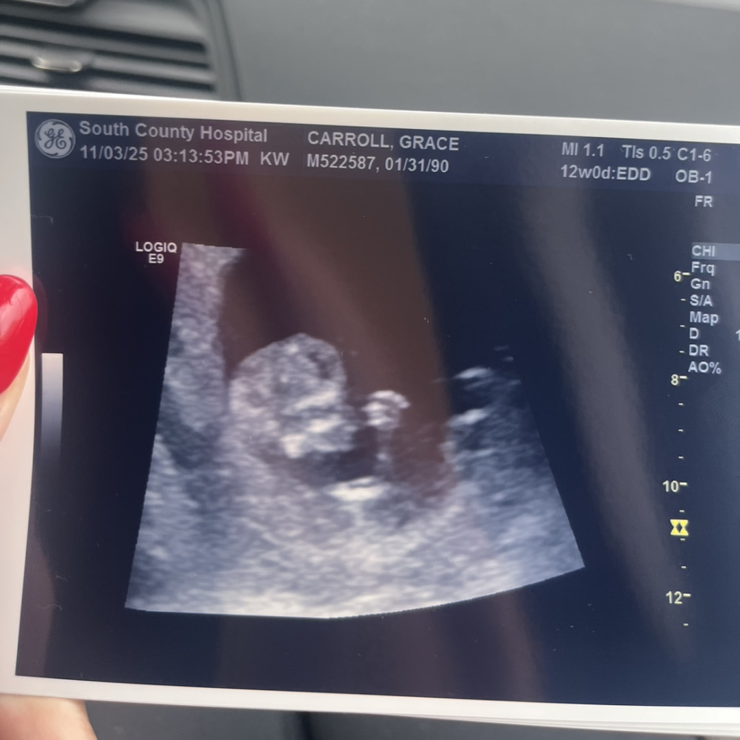 Photo shared by Grace for their Babylist baby registry.