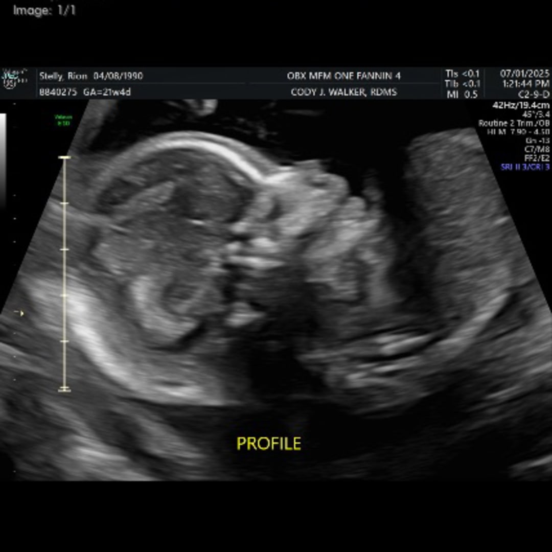 Photo shared by Rion for their Babylist baby registry.