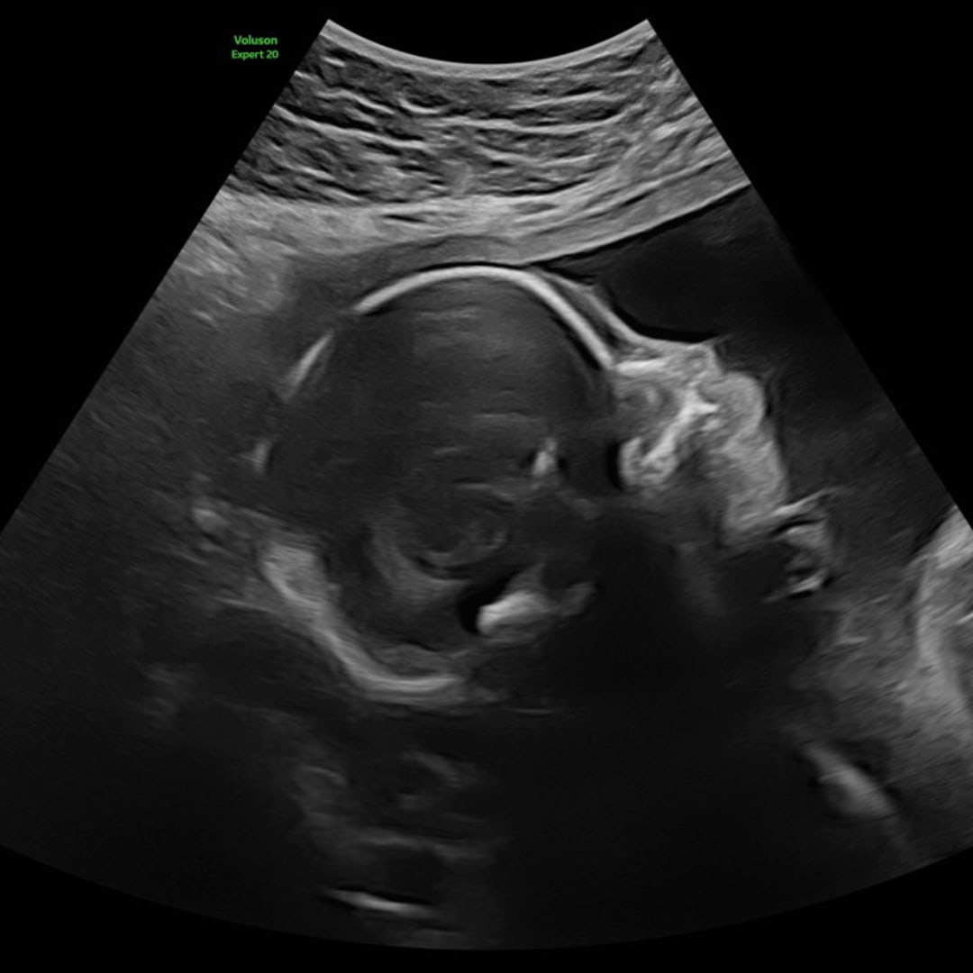 Photo shared by Claire for their Babylist baby registry.