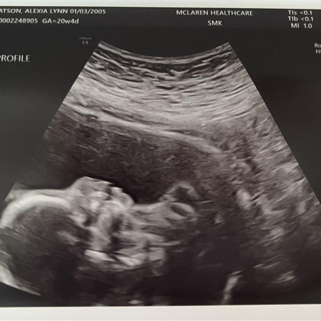 Photo shared by Lexi for their Babylist baby registry.