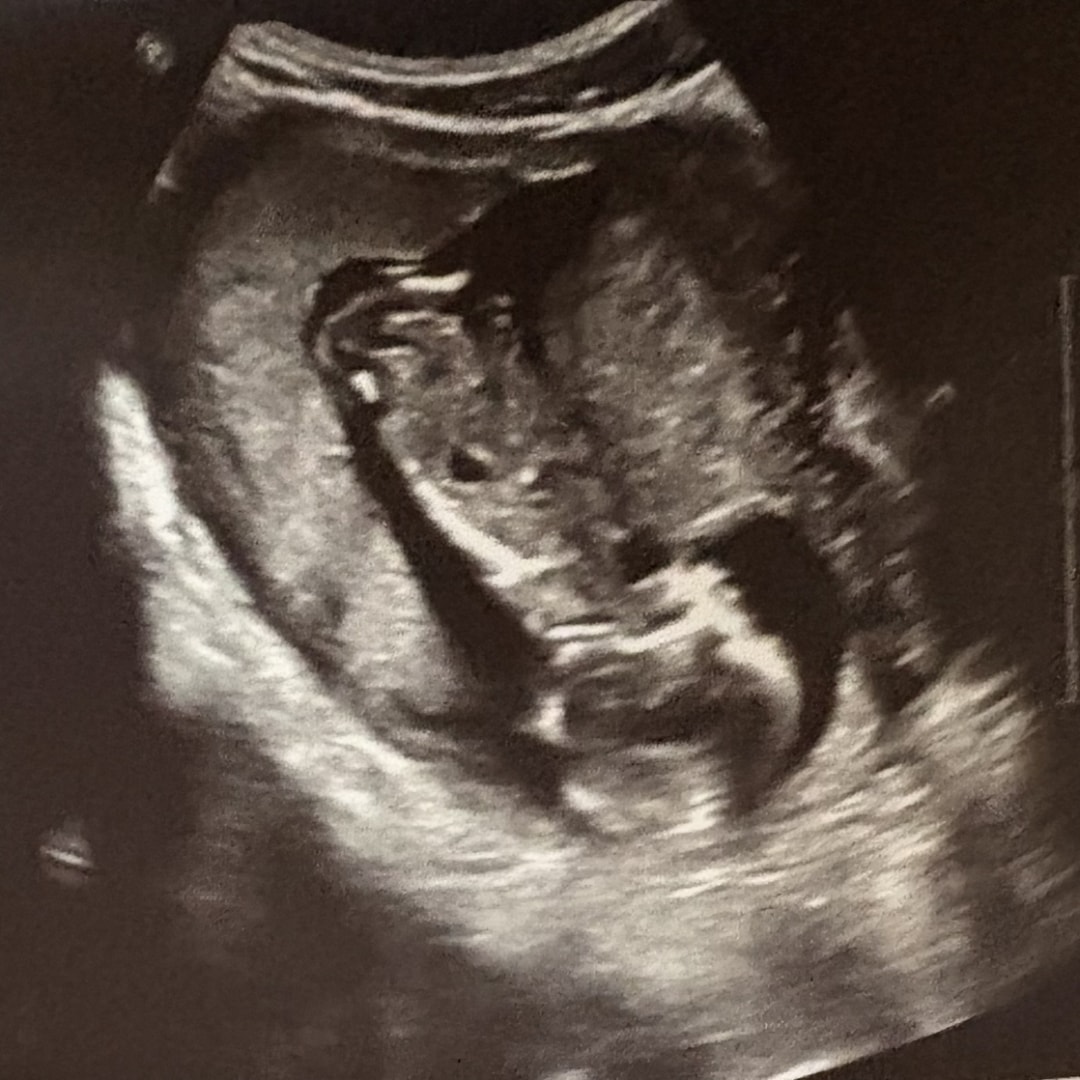 Photo shared by Samone for their Babylist baby registry.