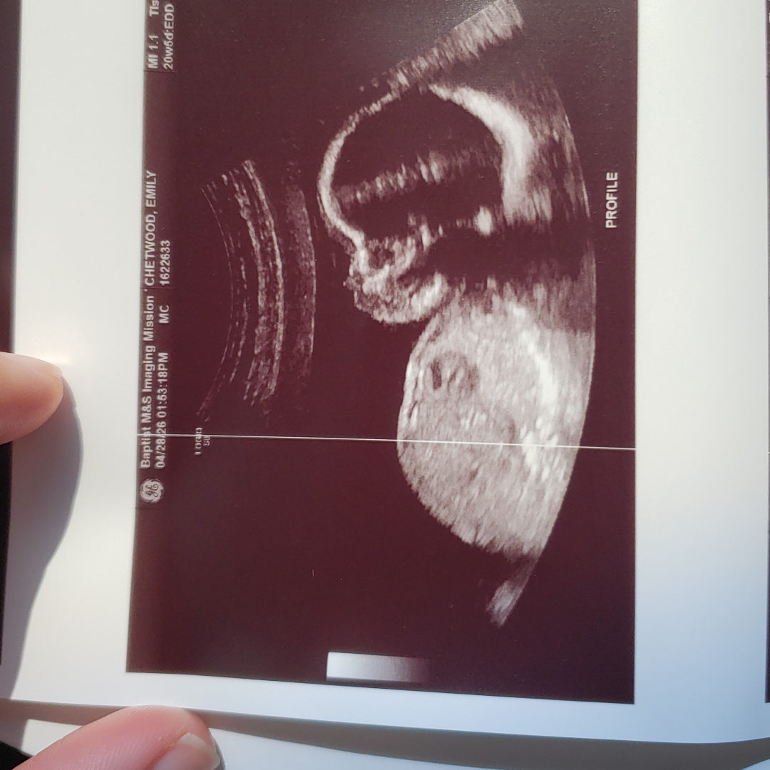 Photo shared by Emily for their Babylist baby registry.
