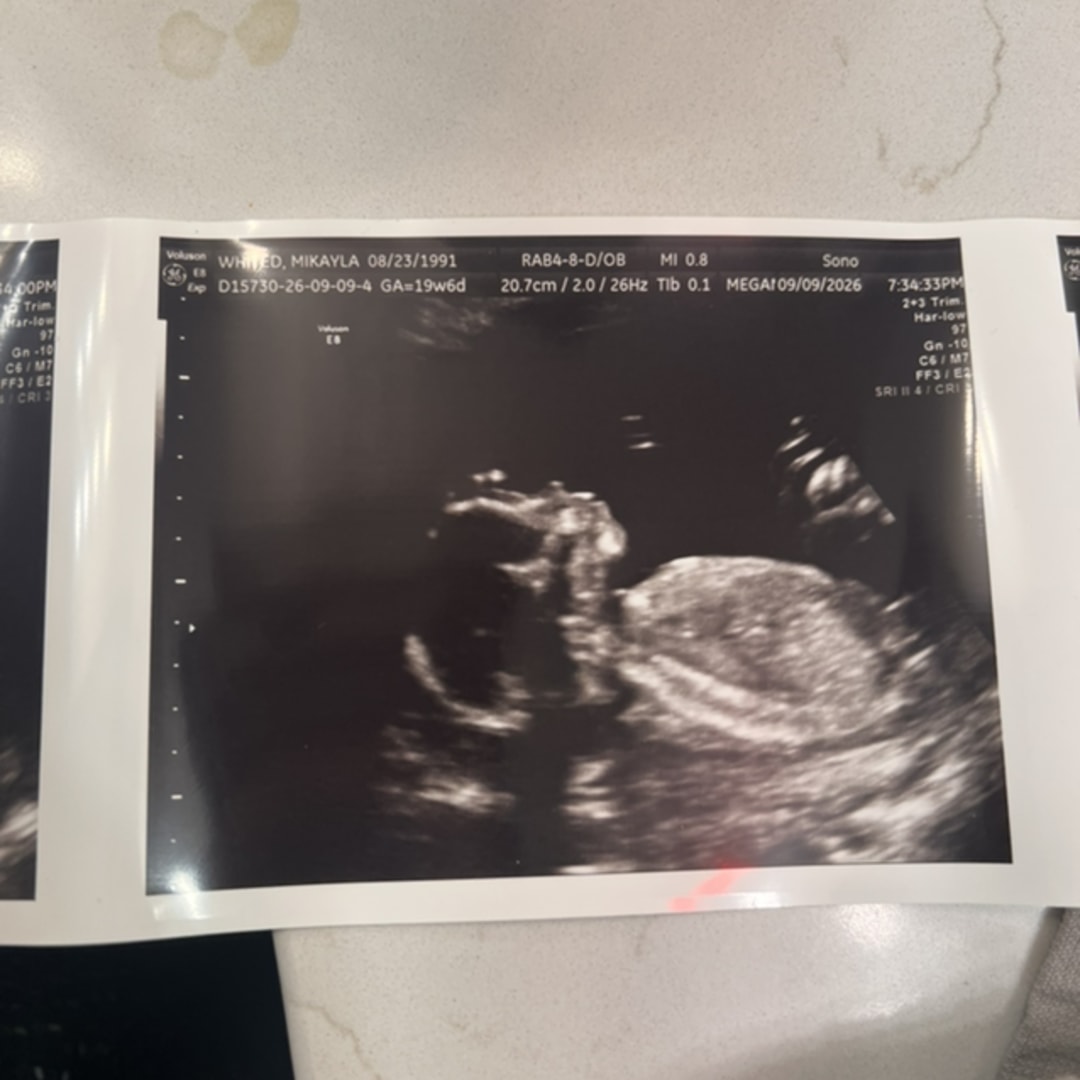 Photo shared by Mikayla for their Babylist baby registry.