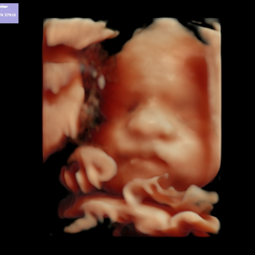 Photo shared by Lacy for their Babylist baby registry.