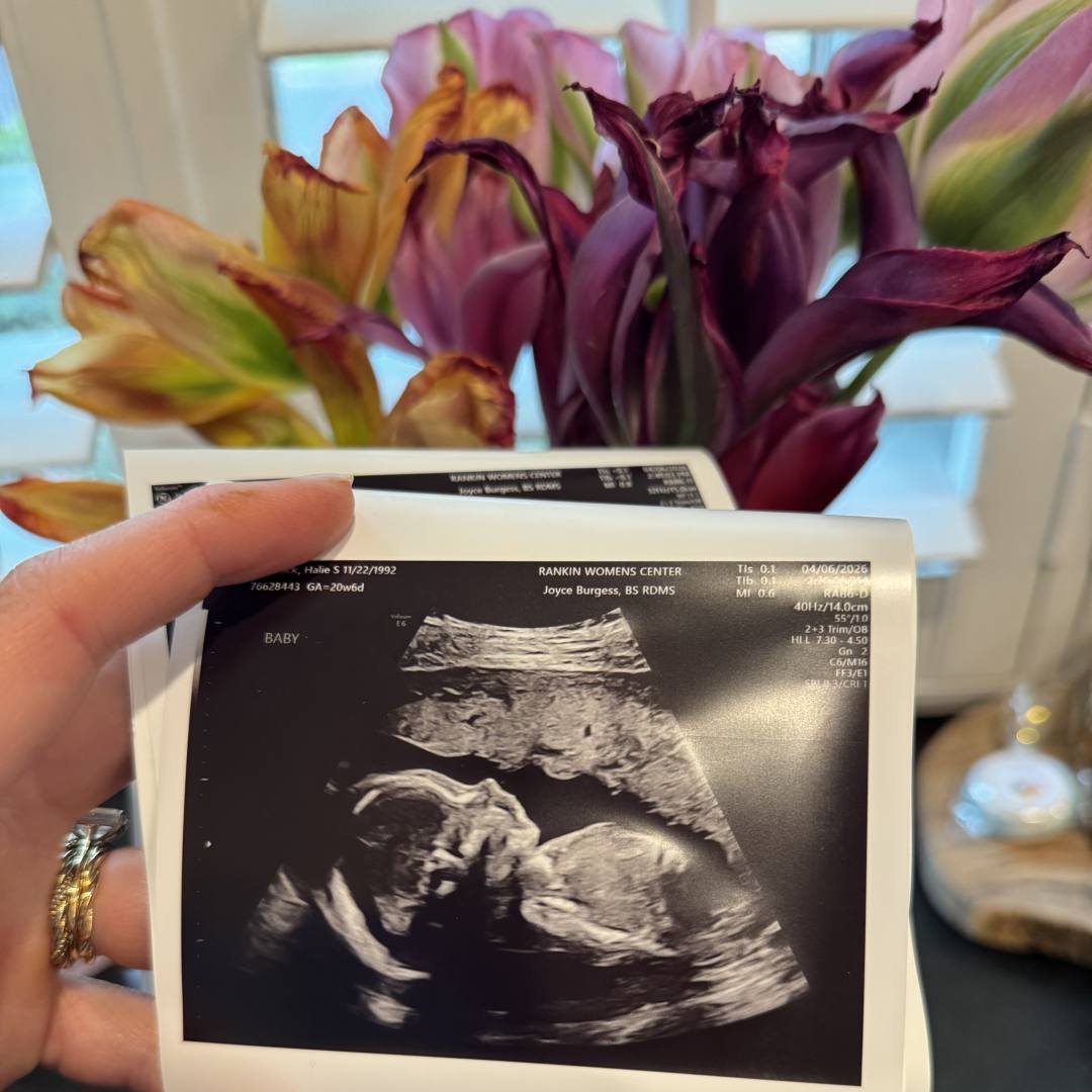 Photo shared by Halie for their Babylist baby registry.