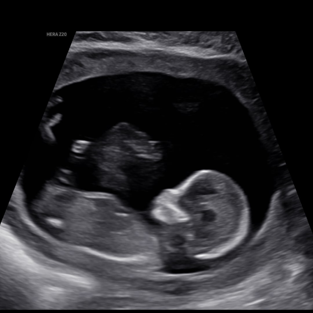 Photo shared by Jacquelyn for their Babylist baby registry.