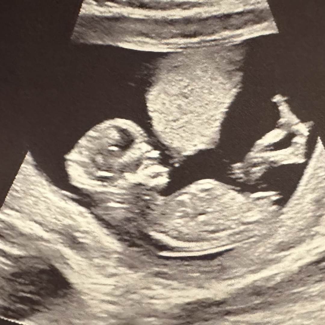 Photo shared by Hannah for their Babylist baby registry.