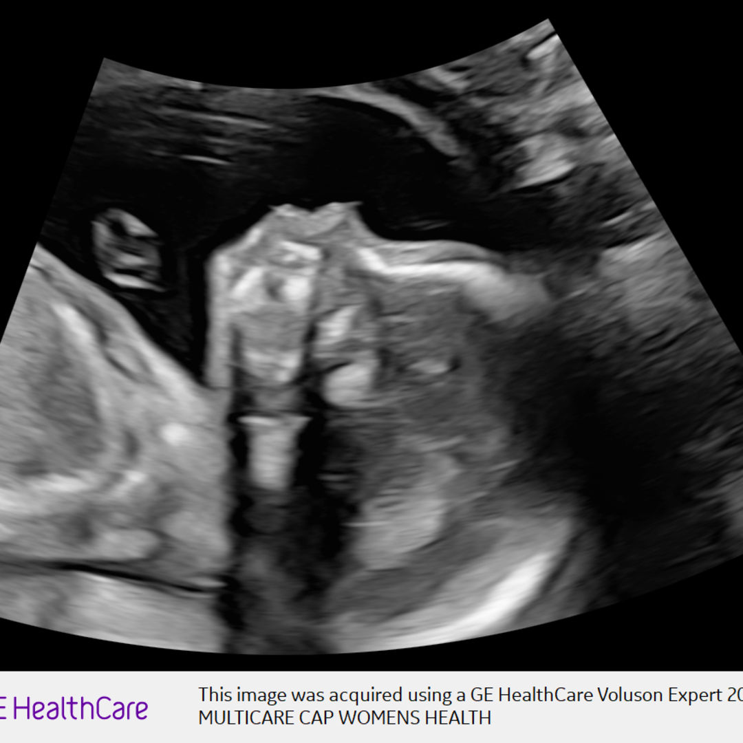 Photo shared by Maura for their Babylist baby registry.