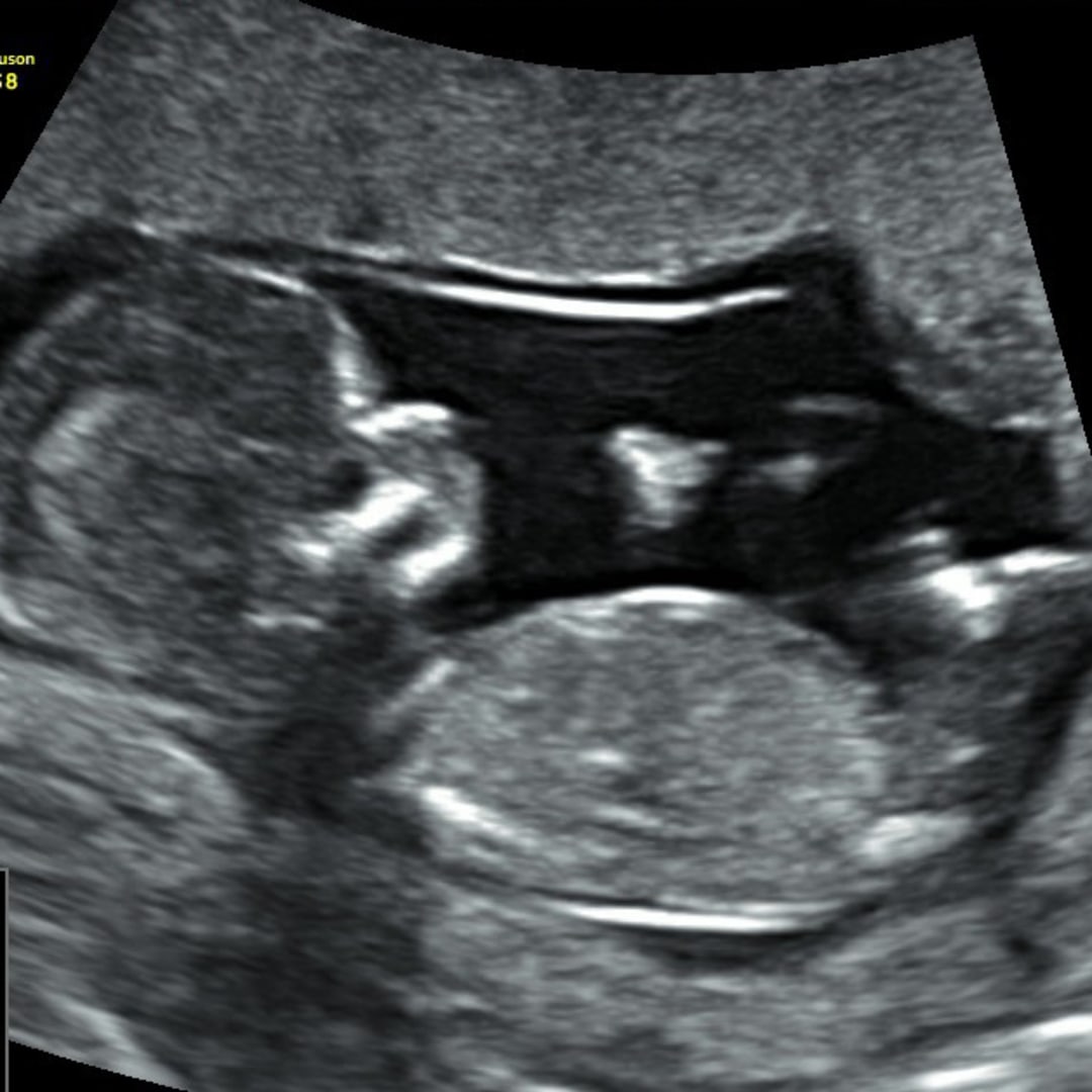 Photo shared by Dana for their Babylist baby registry.