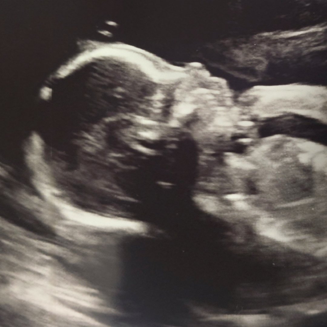 Photo shared by Josiah for their Babylist baby registry.