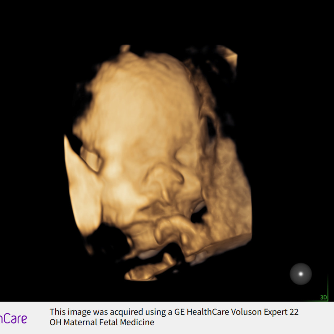 Photo shared by Kati for their Babylist baby registry.