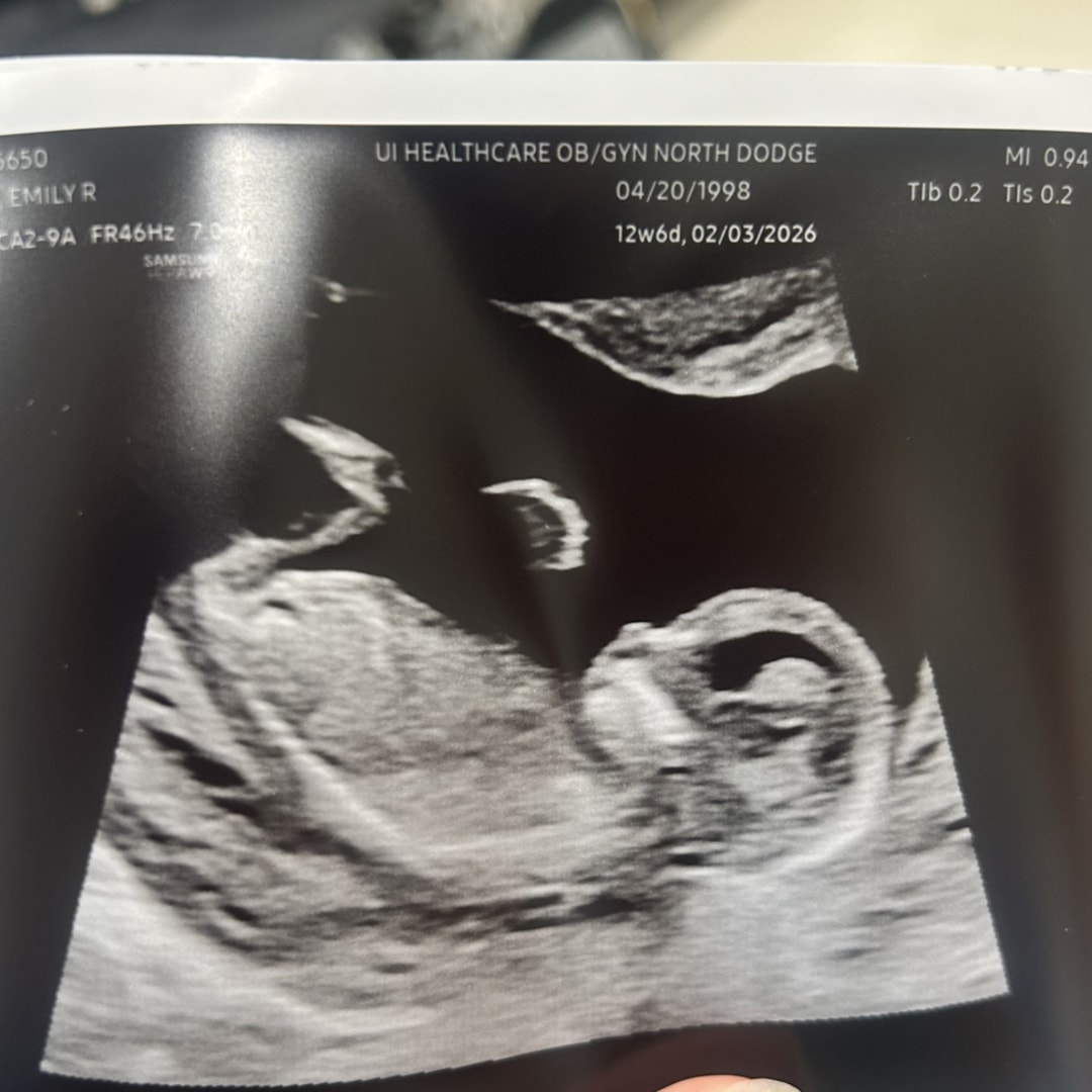 Photo shared by Emily for their Babylist baby registry.