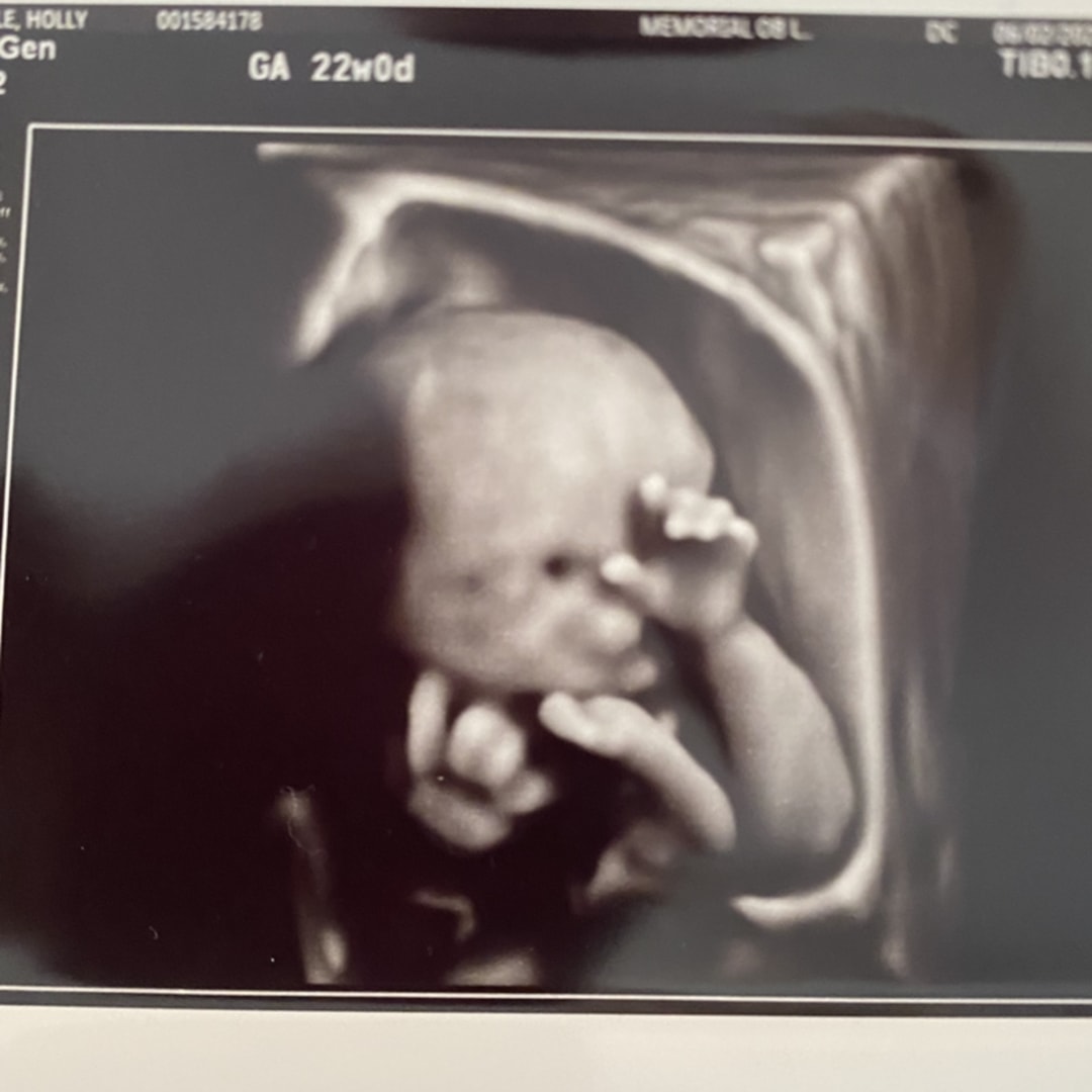 Photo shared by Holly for their Babylist baby registry.