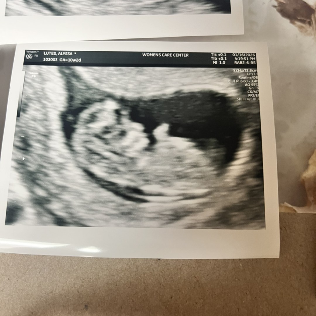 Photo shared by Alyssa for their Babylist baby registry.