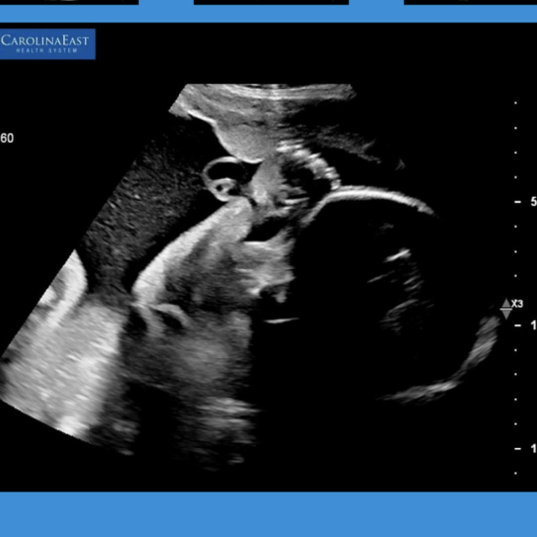 Photo shared by Abigail for their Babylist baby registry.