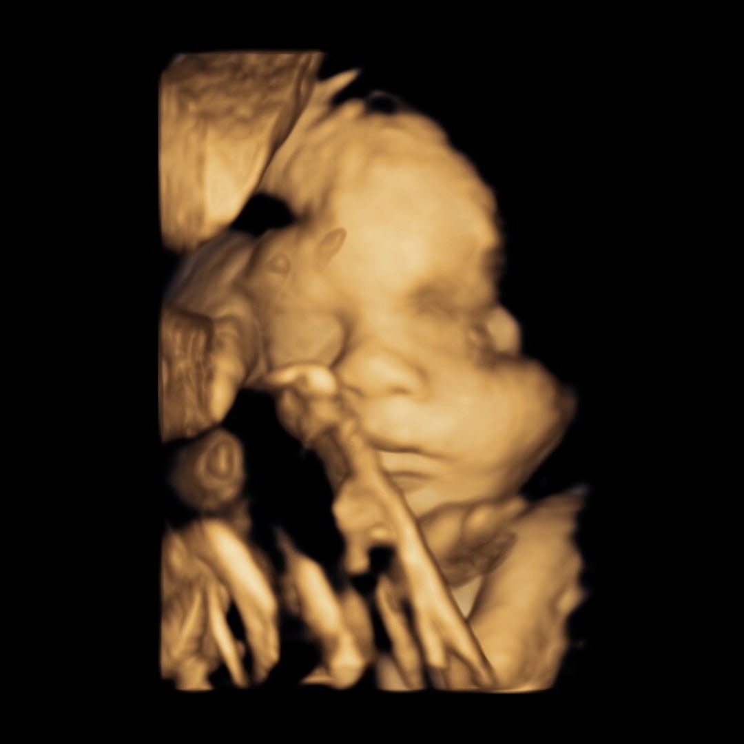 Photo shared by Kalynn for their Babylist baby registry.