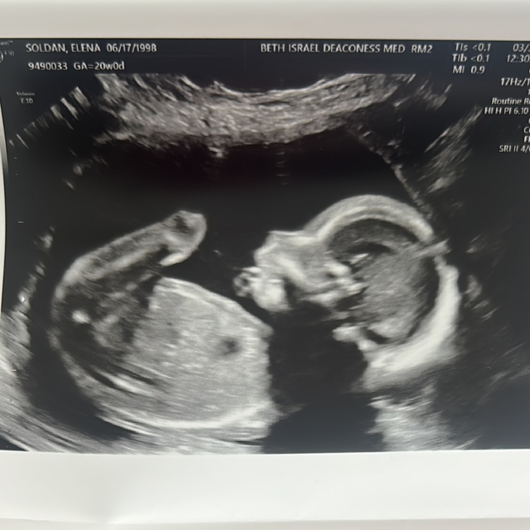 Photo shared by Elena for their Babylist baby registry.