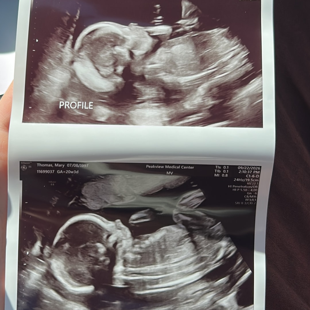 Photo shared by Mary for their Babylist baby registry.