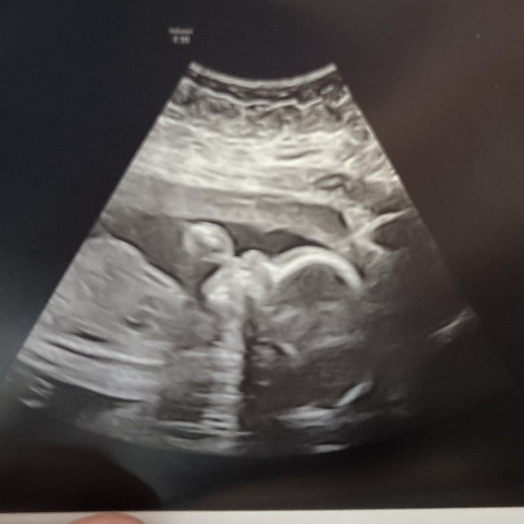 Photo shared by Jessica for their Babylist baby registry.