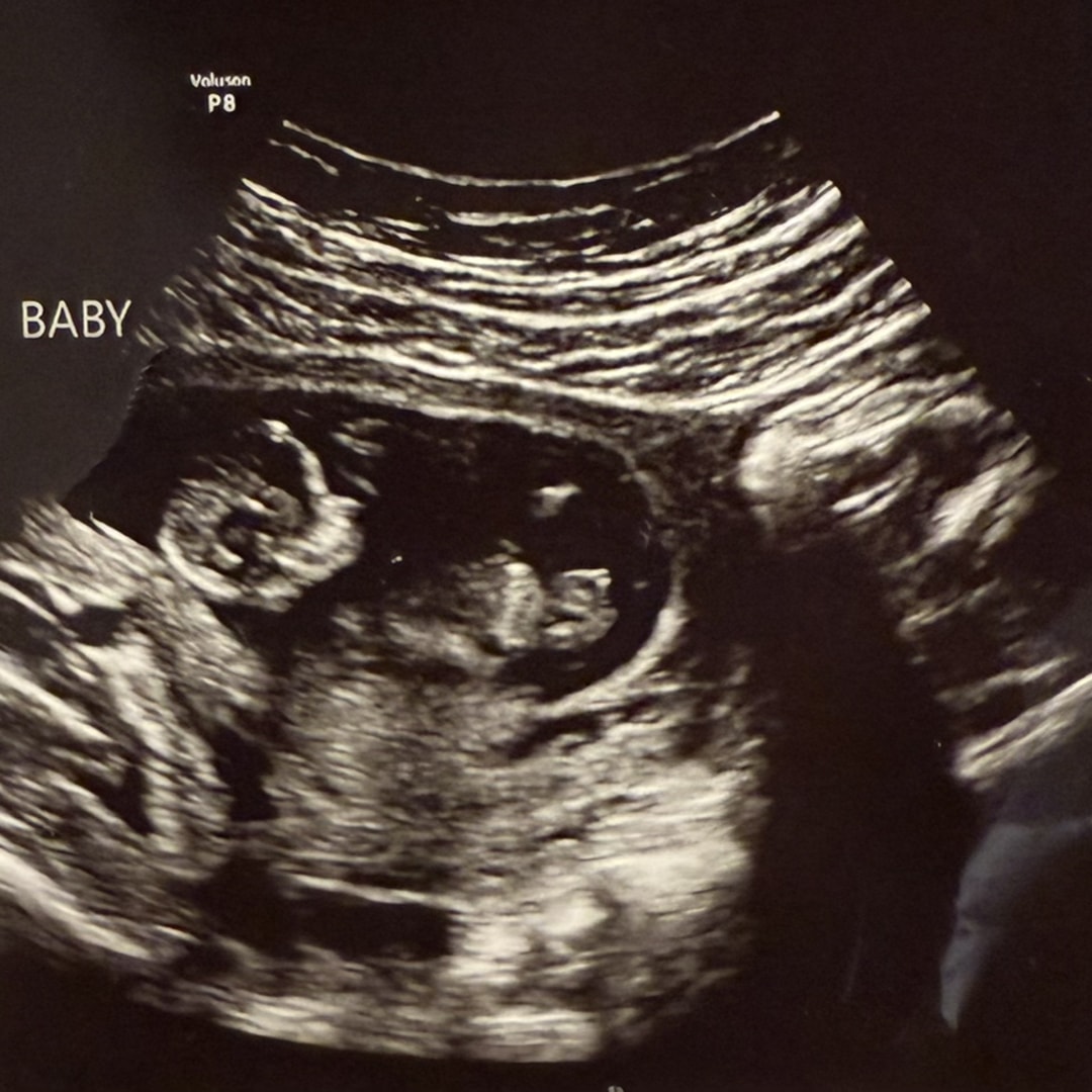 Photo shared by Jaidyn for their Babylist baby registry.