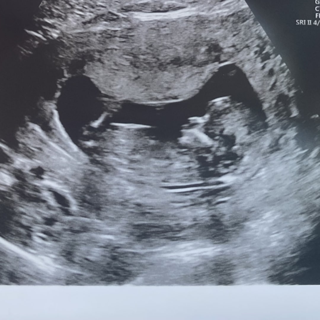 Photo shared by Erica for their Babylist baby registry.