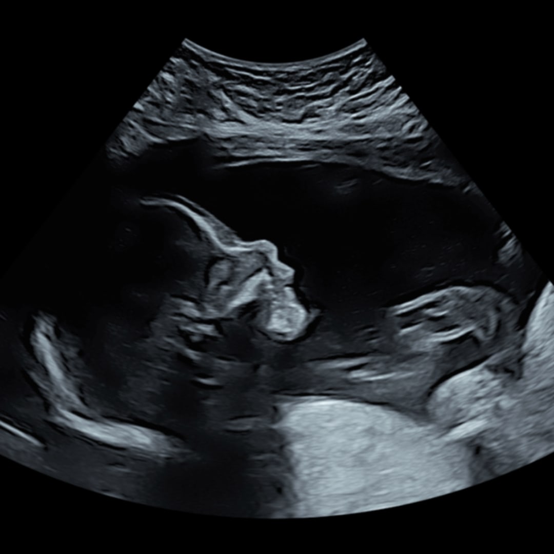 Photo shared by Abigail for their Babylist baby registry.