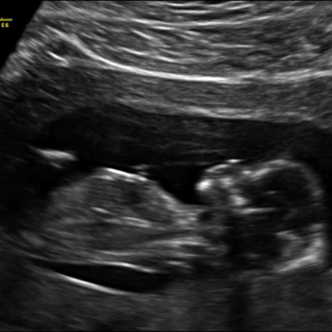 Photo shared by Jakia for their Babylist baby registry.