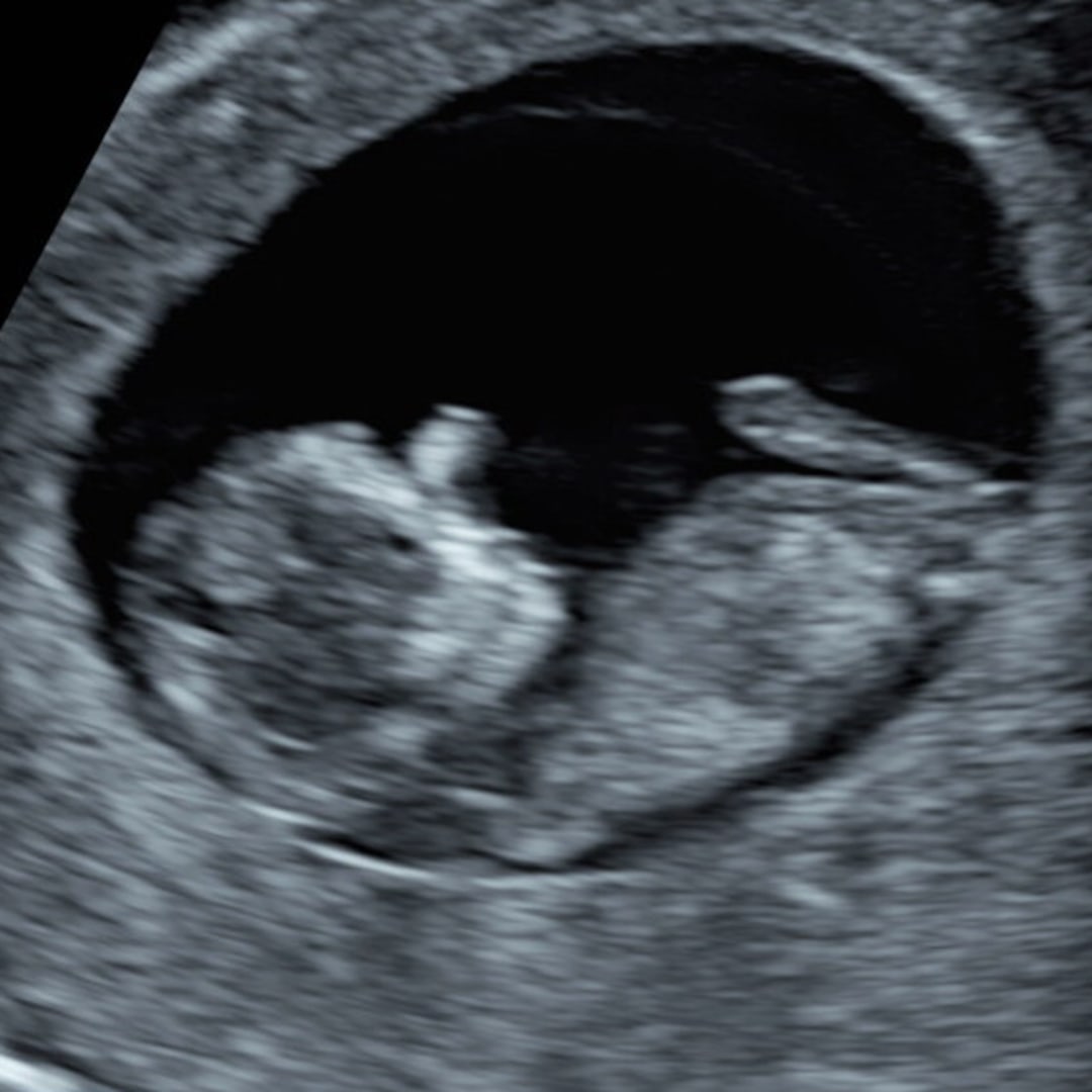 Photo shared by Mary for their Babylist baby registry.