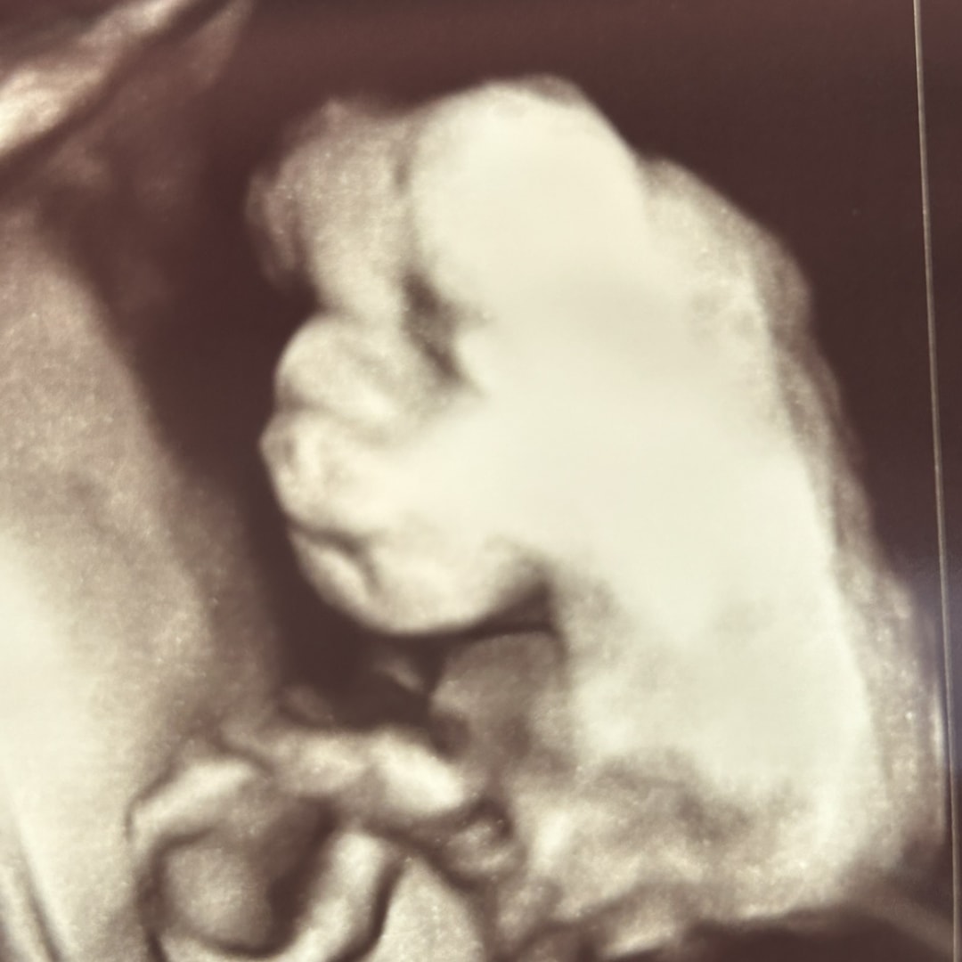 Photo shared by Brianna for their Babylist baby registry.