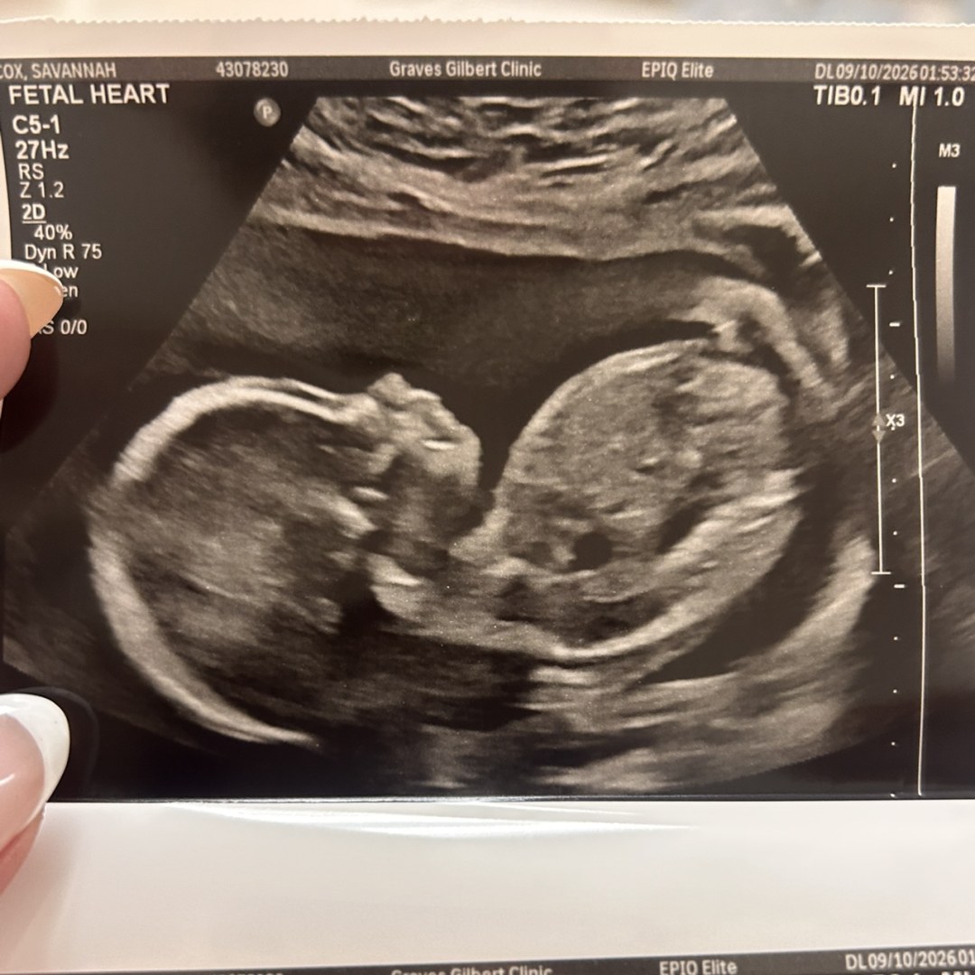 Photo shared by Savannah for their Babylist baby registry.