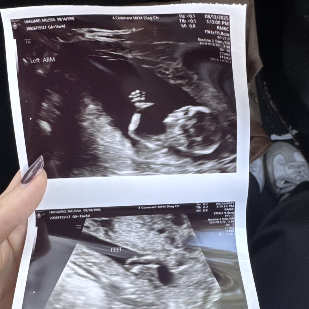 Photo shared by Melissa for their Babylist baby registry.
